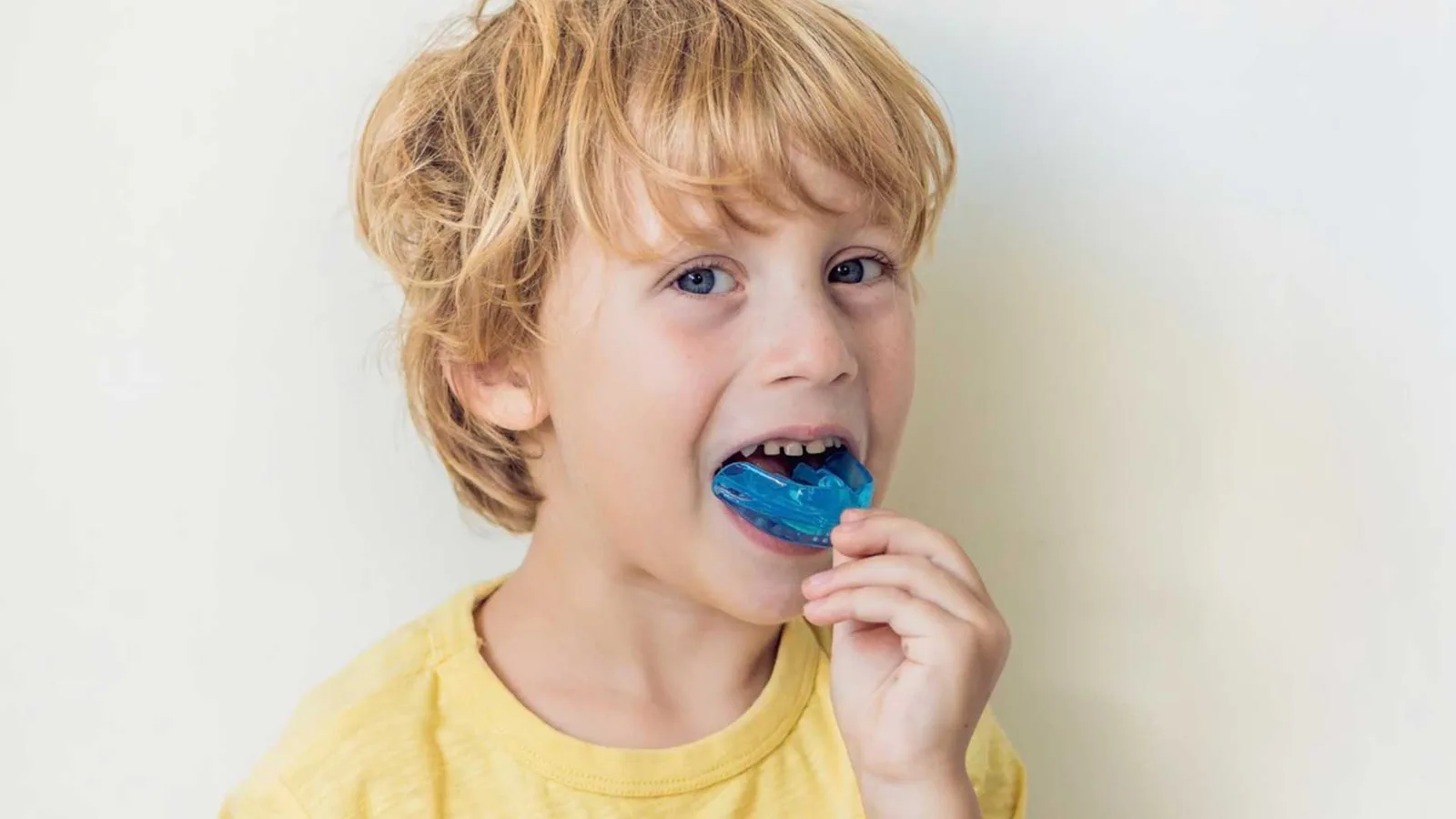 Mouthguards