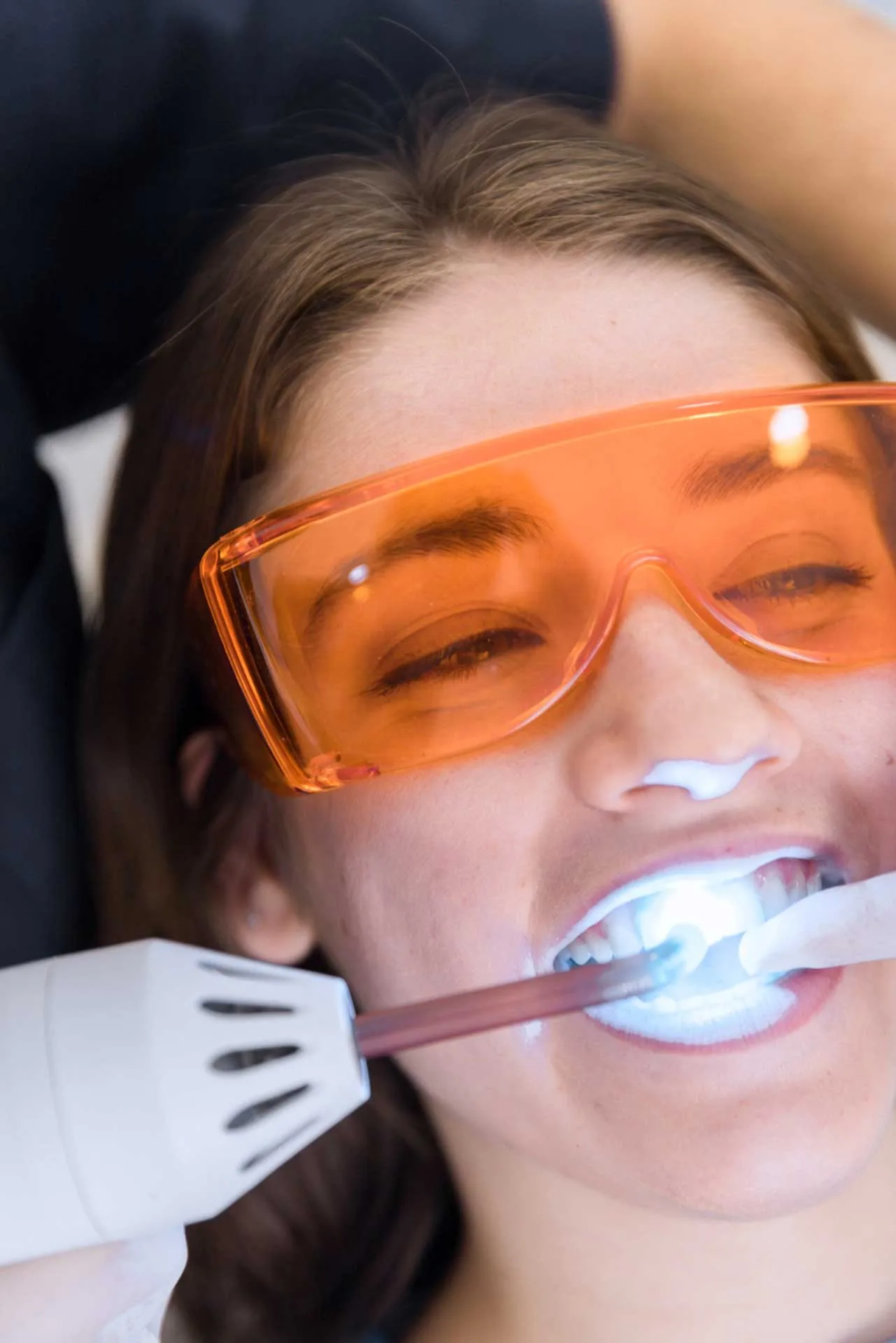 My Dentist Geelong (Highton) offers professional teeth whitening treatments to brighten your smile and remove stubborn stains in Geelong.