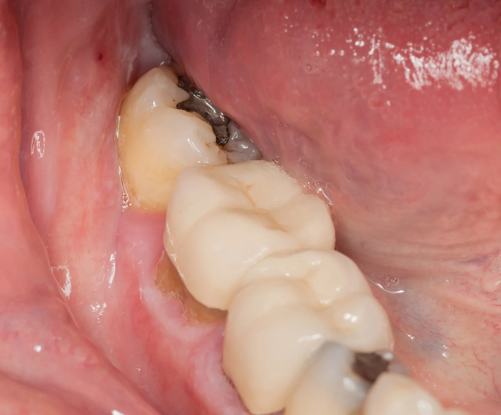 close-up-macro-shot-of-interior-of-mouth-and-filli-2026-03-26-10-40-45-utc