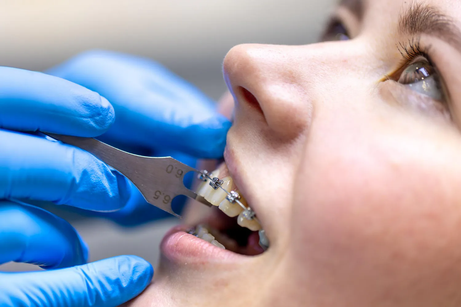 Dentist adjusting and tightening the patient’s braces.