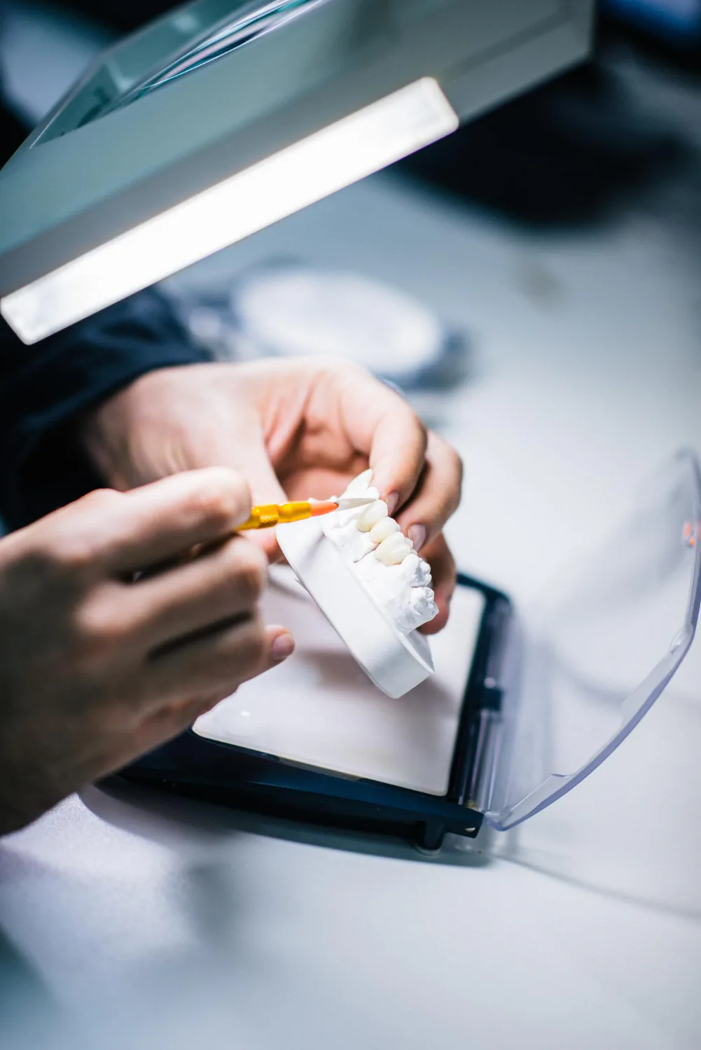 Dentist fabricating dental veneers at the lab.