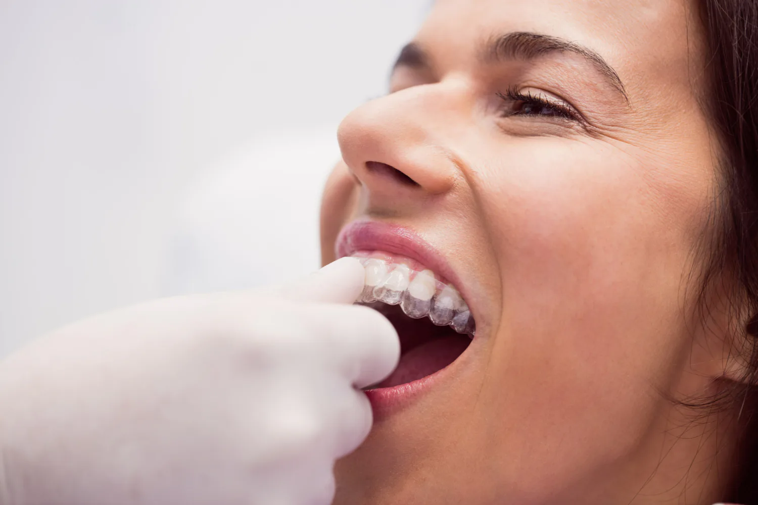 Dentist fitting Invisalign on a patient.