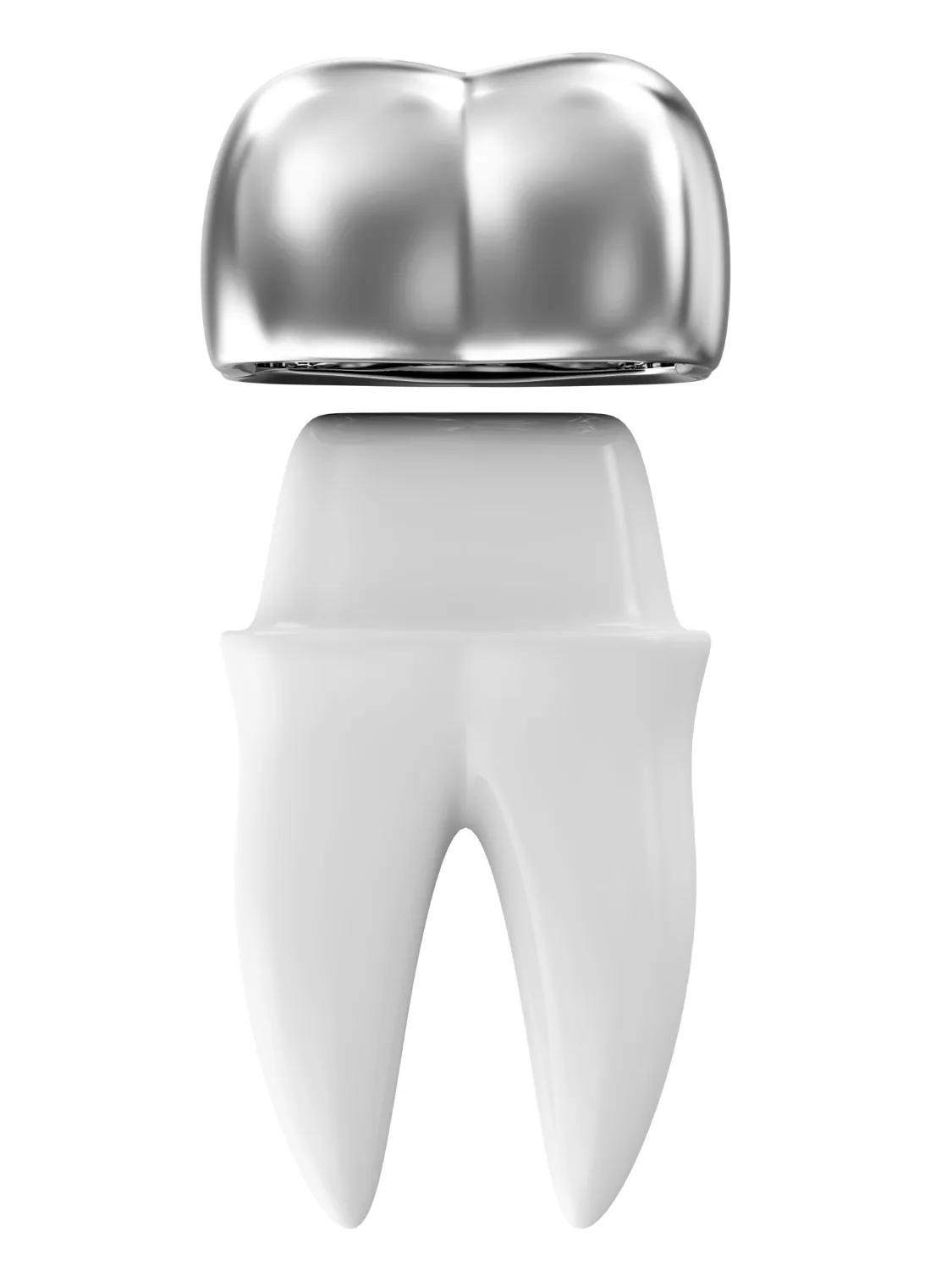Metal alloy crowns are highly resistant to wear.