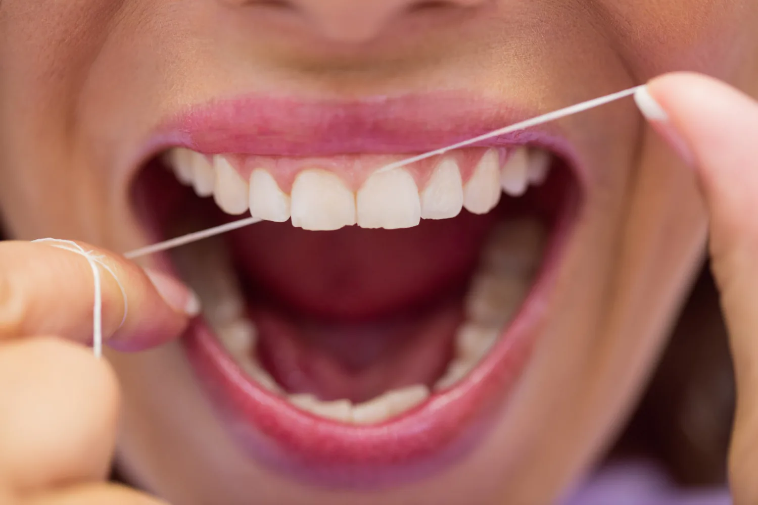 Patient flossing their teeth regularly to ensure their veneers are in good condition.