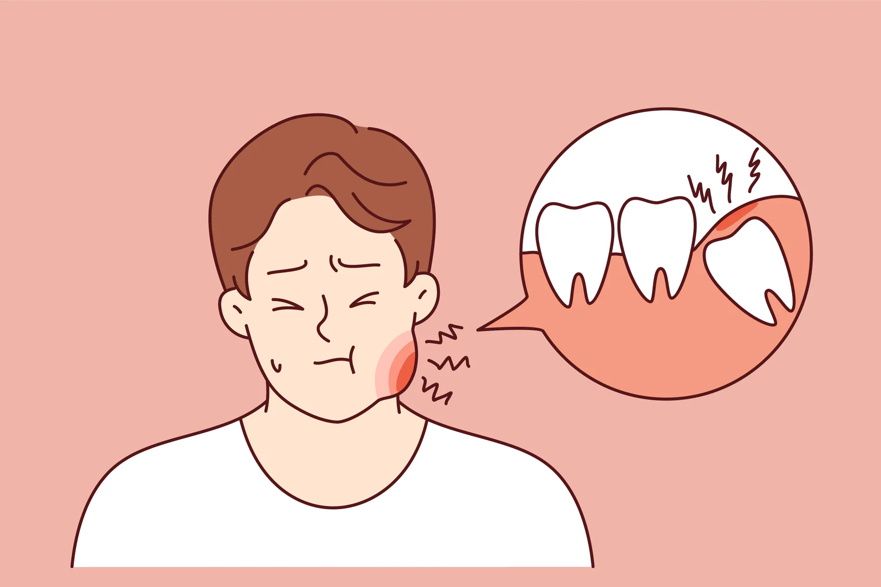 Wisdom teeth can cause inflammation, making it uncomfortable and painful.
